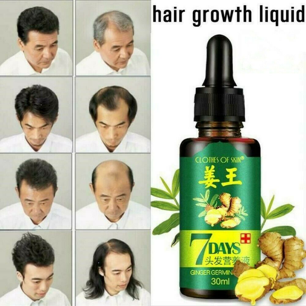 ginger hair growth essence promoting thick and strong hair roots