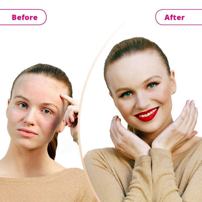 Before and after comparison of a woman's face with visible skin improvement.