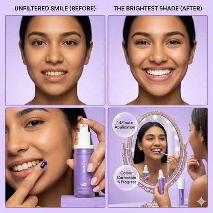 A four-panel promotional collage for a purple cosmetic bottle. The top row shows a before-and-after face comparison labeled 'UNFILTERED SMILE (BEFORE)' and 'THE BRIGHTEST SHADE (AFTER)'.