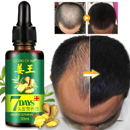 ginger hair oil ingredients zingiber officinale and vitamin e