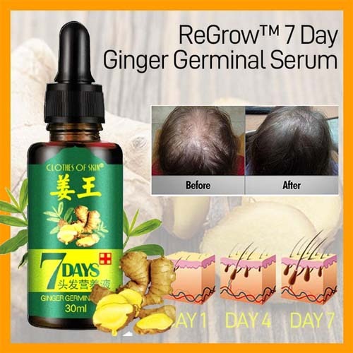 hair follicle stimulation with 7 day ginger hair oil