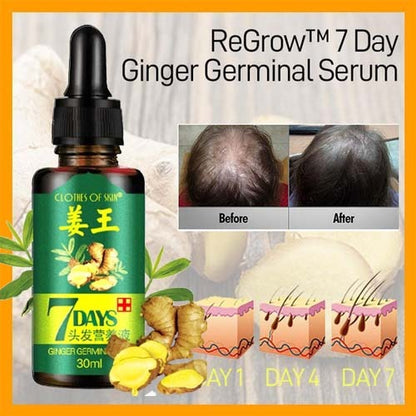 hair follicle stimulation with 7 day ginger hair oil