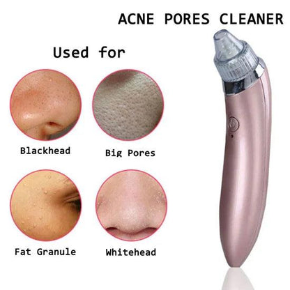 deep pore suction blackhead extractor for clear skin