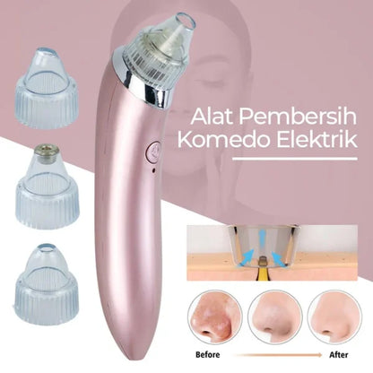 usb rechargeable blackhead remover facial cleaner box packaging pakistan